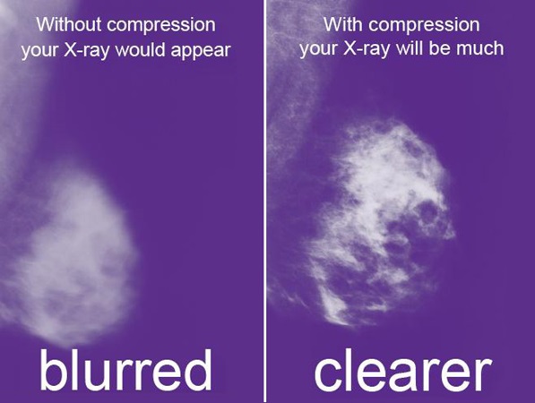 blurred x-ray vs clear x-ray